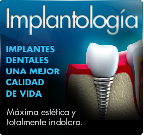 implante dental